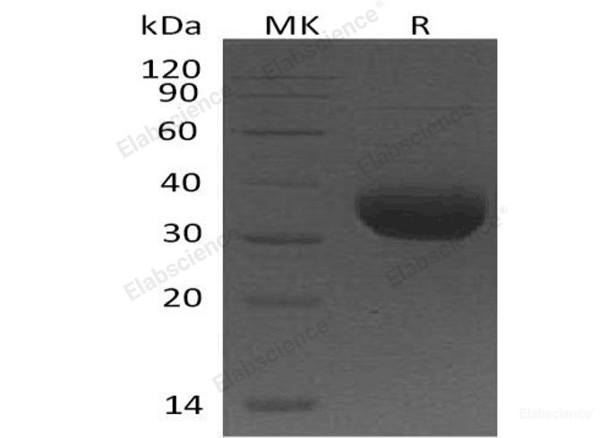 Recombinant Human Butyrophilin 1A1/BTN1A1 Protein(C-6His)-Elabscience