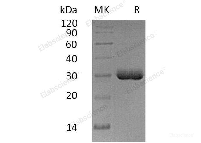 Recombinant Human Butyrophilin 3A2/BTN3A2 Protein(C-6His)-Elabscience