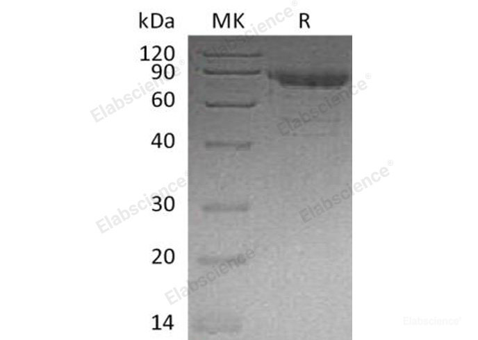 Recombinant Human Cadherin-11/OB-Cadherin/CDH11 Protein(C-6His)-Elabscience