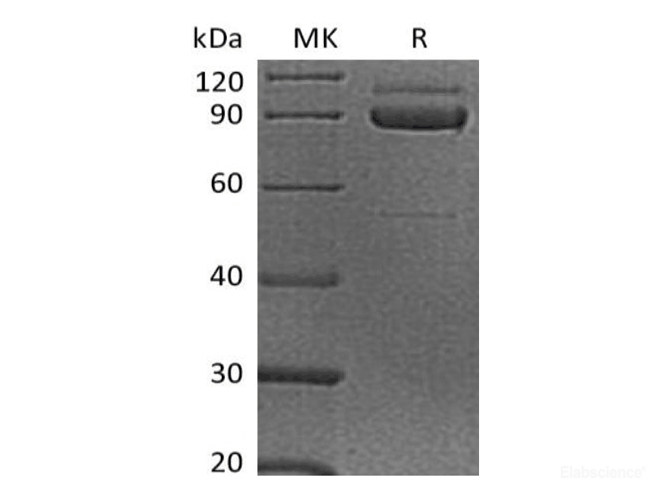 Recombinant Human Cadherin-3/CDH3 Protein(C-6His)-Elabscience