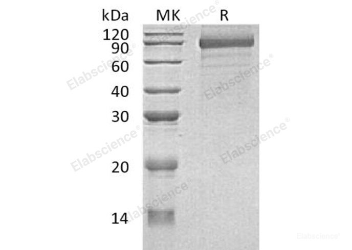 Recombinant Human Cadherin-8/CDH8 Protein(C-6His)-Elabscience