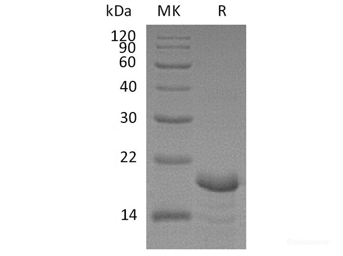 Recombinant Human Calcineurin Subunit B1/CNB1 Protein(N-6His)-Elabscience