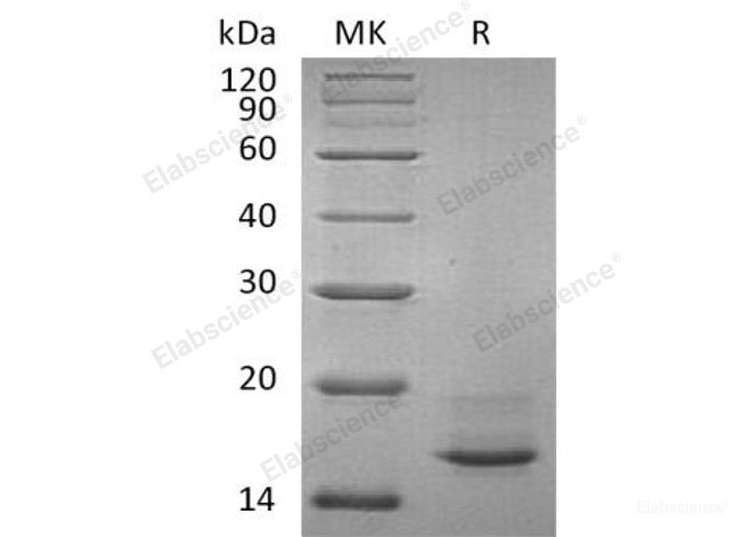 Recombinant Human Calcitonin/CALCA Protein(C-6His)-Elabscience