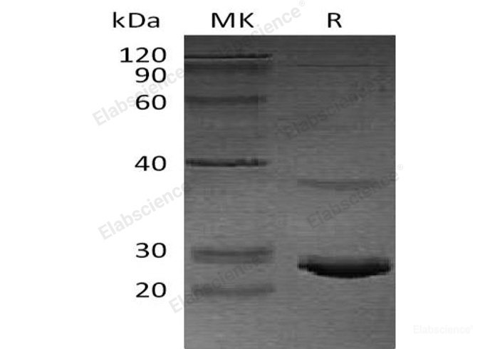 Recombinant Human Calcitonin/CALCA Protein(C-6His, E. coli)-Elabscience