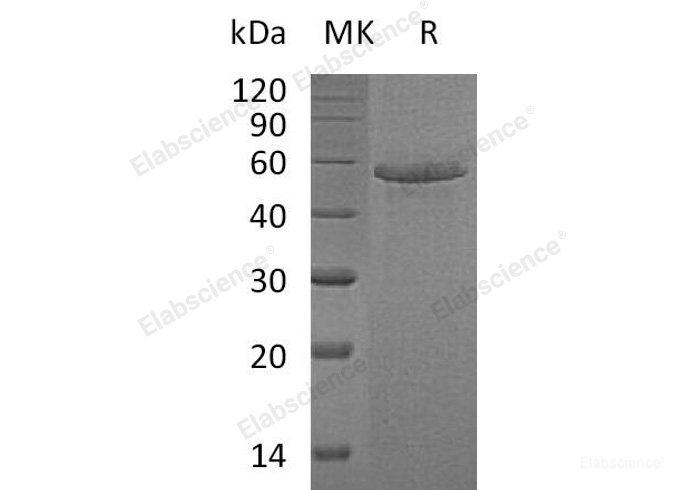 Recombinant Human Calmegin/CLGN Protein(C-6His)-Elabscience