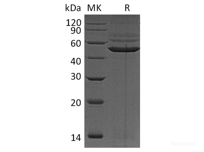 Recombinant Human cAMP-Dependent Protein Kinase 1α/PRKAR1A Protein(C-6His)-Elabscience