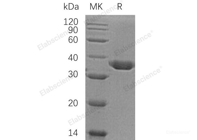 Recombinant Human Carbonic Anhydrase 10/CA10 Protein(C-6His)-Elabscience