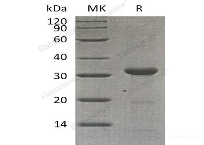 Recombinant Human Carbonic Anhydrase 10/CA10 Protein(N-6His)-Elabscience