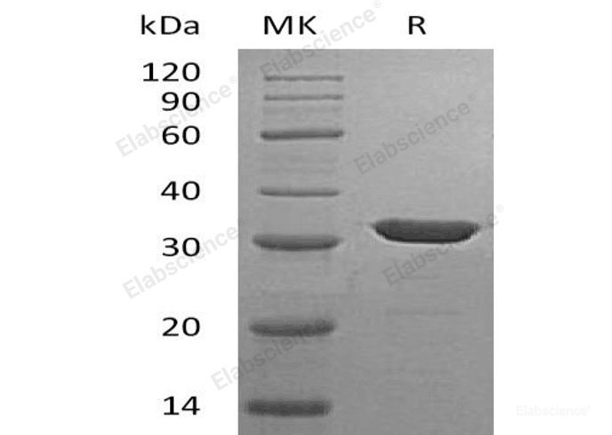 Recombinant Human Carbonic Anhydrase 13/CA13 Protein(C-6His)-Elabscience