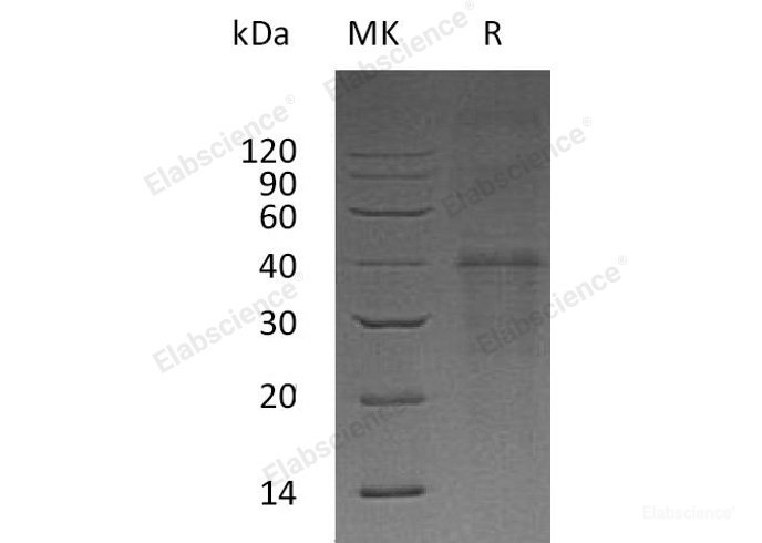 Recombinant Human Carbonic Anhydrase 14/CA14 Protein(N-6His)-Elabscience