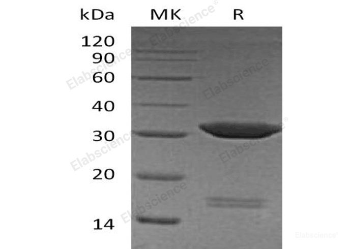 Recombinant Human Carbonic Anhydrase 4/CA4 Protein(C-6His)-Elabscience