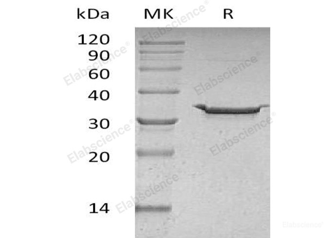 Recombinant Human Carbonic Anhydrase 5B/CA5B Protein(C-6His)-Elabscience