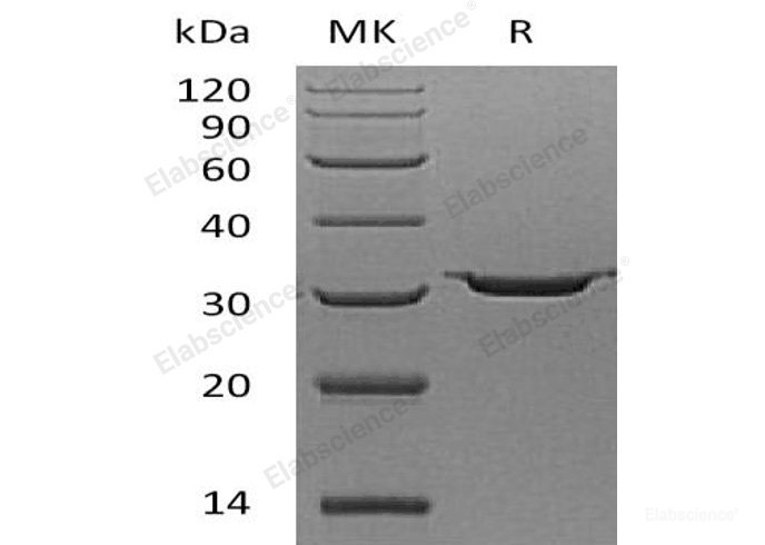 Recombinant Human Carbonic Anhydrase 7/CA7 Protein(C-6His)-Elabscience