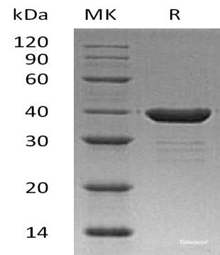 Recombinant Human Carbonic Anhydrase 8/CA8 Protein(C-6His)-Elabscience