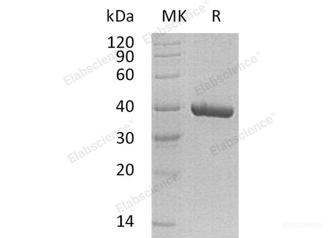 Recombinant Human Carbonic Anhydrase-Related Protein 11/CA11 Protein(C-6His)-Elabscience