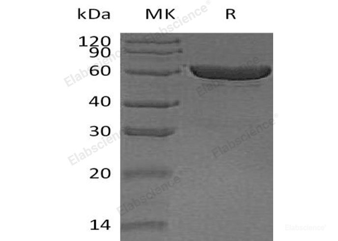 Recombinant Human Carboxylesterase 1/CES1 Protein(C-6His)-Elabscience