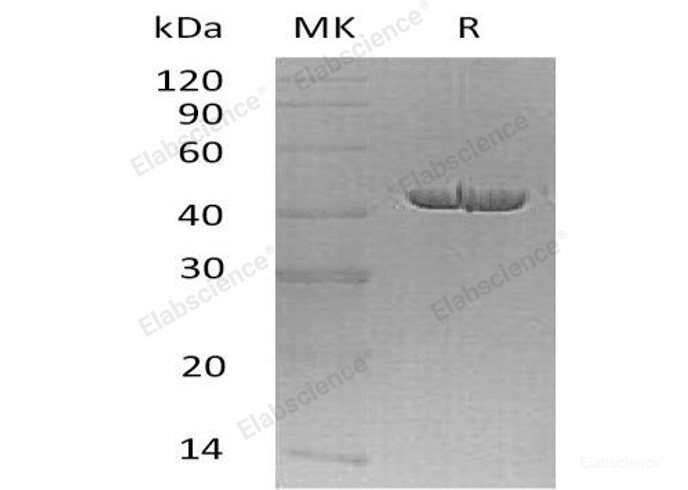 Recombinant Human Carboxypeptidase A1/CPA1 Protein(C-6His)-Elabscience
