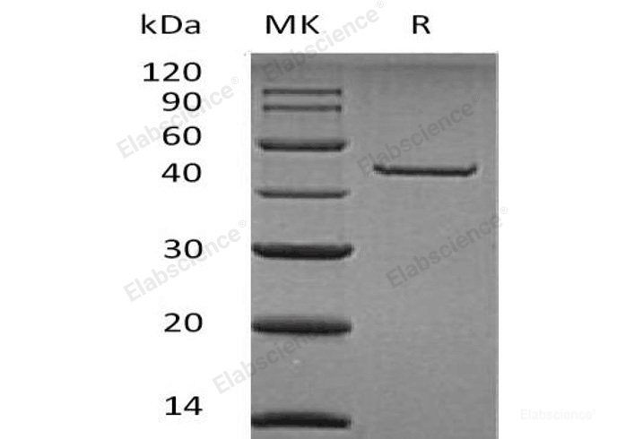 Recombinant Human Carboxypeptidase A2/CPA2 Protein(C-6His)-Elabscience