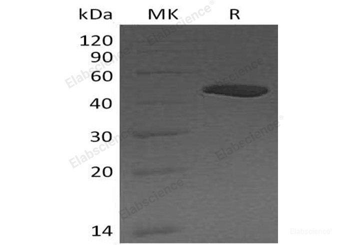 Recombinant Human Carboxypeptidase B/CPB1 Protein(C-6His)-Elabscience