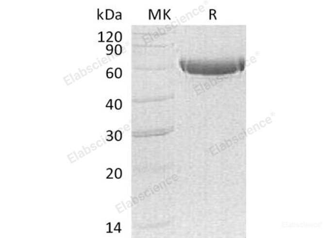Recombinant Human Carboxypeptidase B2/CPB2 Protein(C-6His)-Elabscience