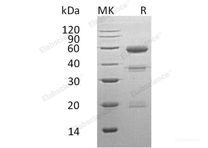 Recombinant Human Carboxypeptidase E/CPE Protein(C-6His)-Elabscience