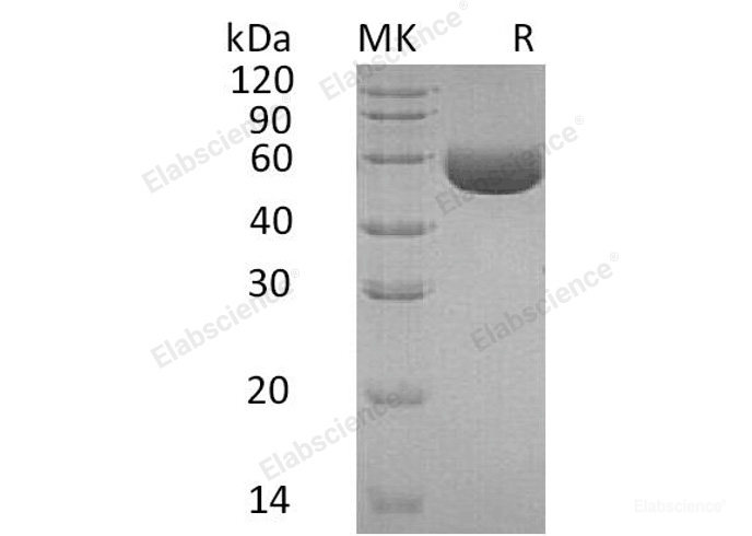Recombinant Human Carboxypeptidase M/CPM Protein(C-6His)-Elabscience