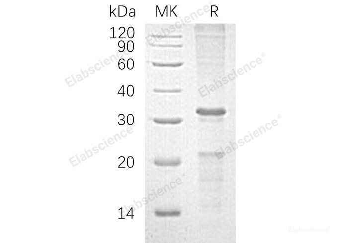 Recombinant Human Caspase-10/CASP10 Protein(C-6His)-Elabscience