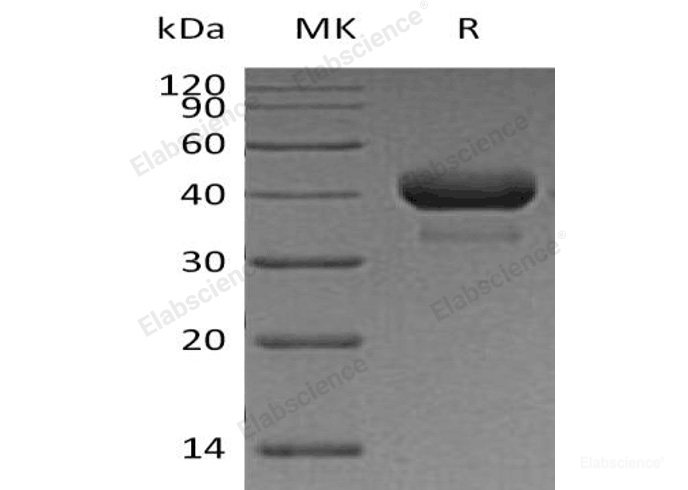 Recombinant Human Cathepsin B/CTSB Protein(C-6His)-Elabscience