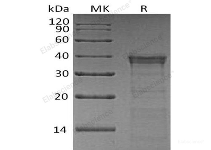 Recombinant Human Cathepsin L2/CTSL2 Protein(C-6His)-Elabscience