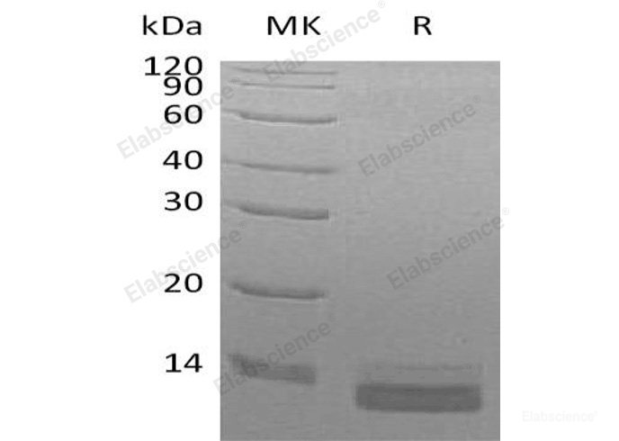 Recombinant Human C-C Motif Chemokine 14/CCL14/HCC-3 Protein(C-6His)-Elabscience