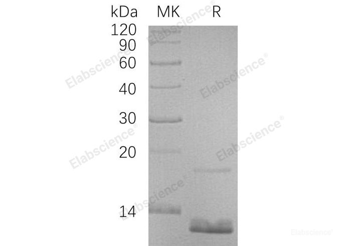 Recombinant Human C-C Motif Chemokine 18/CCL18/PARC Protein(N-6His)-Elabscience