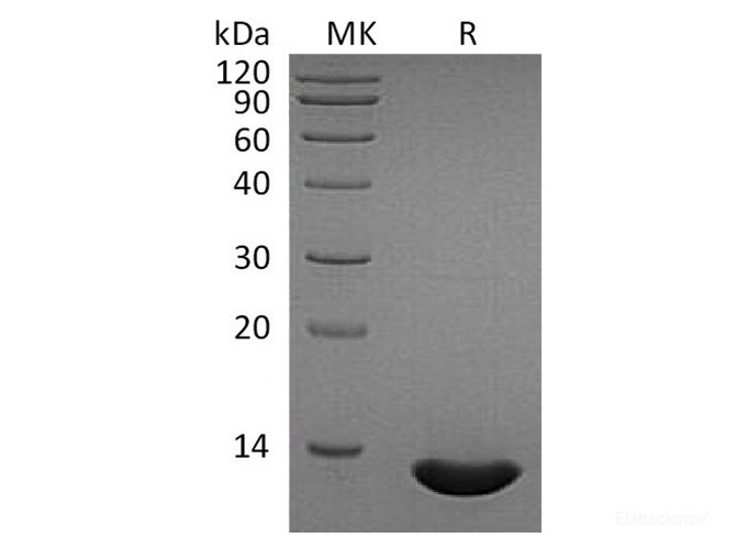 Recombinant Human C-C Motif Chemokine 2/CCL2/MCP-1 Protein-Elabscience