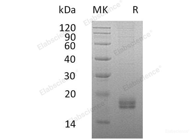 Recombinant Human C-C Motif Chemokine 24/CCL24/Eotaxin-2/MPIF-2 Protein(C-6His)-Elabscience