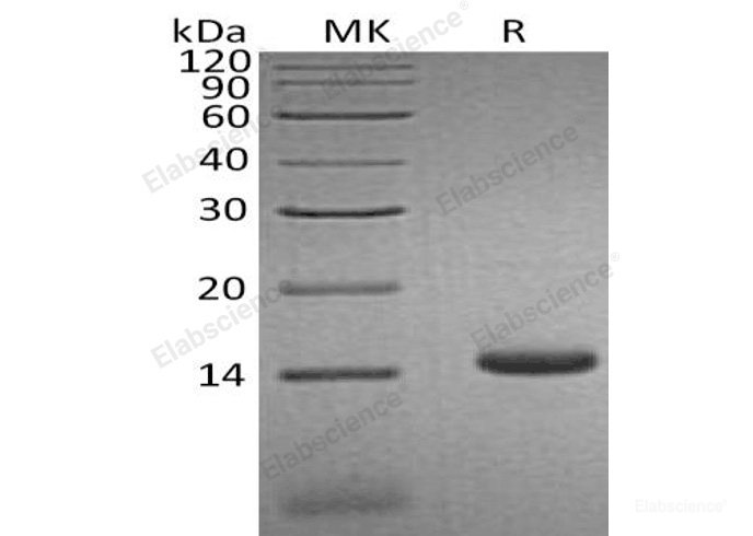 Recombinant Human C-C Motif Chemokine 3-Like 1/CCL3L1 Protein(C-6His)-Elabscience