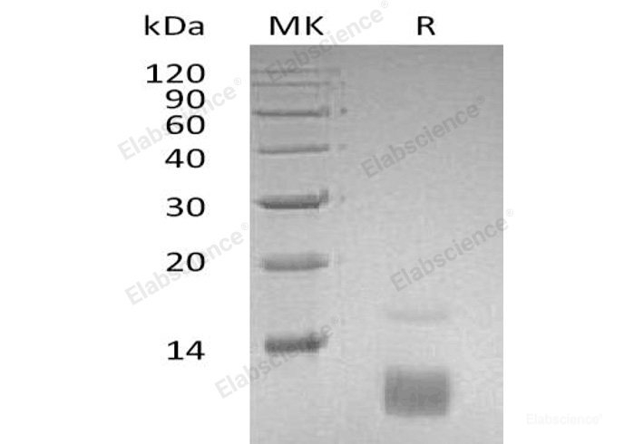 Recombinant Human C-C Motif Chemokine 5/CCL5/RANTES Protein-Elabscience
