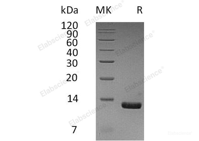 Recombinant Human C-C Motif Chemokine 8/CCL8/MCP-2 Protein(C-6His)-Elabscience