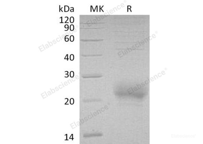 Recombinant Human CD160/BY55 Protein(C-6His)-Elabscience