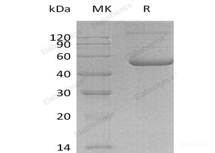 Recombinant Human CD27 Ligand/TNFSF7/CD70 Protein(C-Fc)-Elabscience