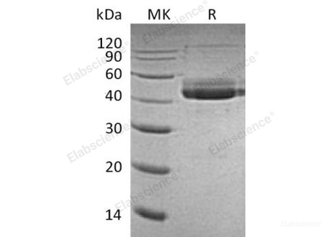 Recombinant Human CD3 ε/CD3E Protein(C-Fc)-Elabscience