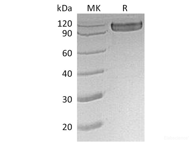 Recombinant Human CD30/TNFRSF8/CD30L Receptor Protein(C-Fc)-Elabscience