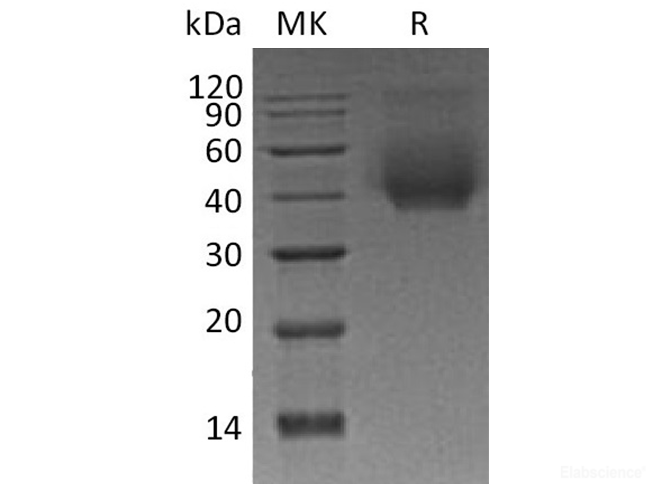 Recombinant Human CD44/MIC4 Protein(C-6His)-Elabscience