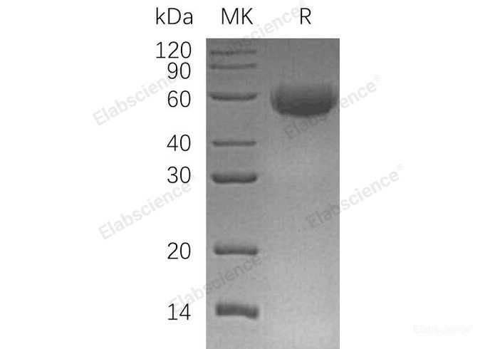 Recombinant Human CD46/MCP Protein(C-6His)-Elabscience