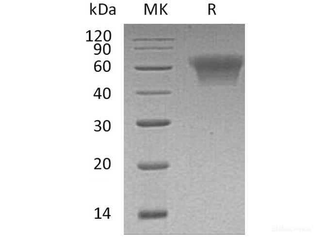 Recombinant Human CD55/DAF Protein(C-6His)-Elabscience