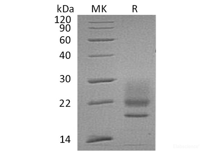Recombinant Human CD83/HB15 Protein(C-6His)-Elabscience