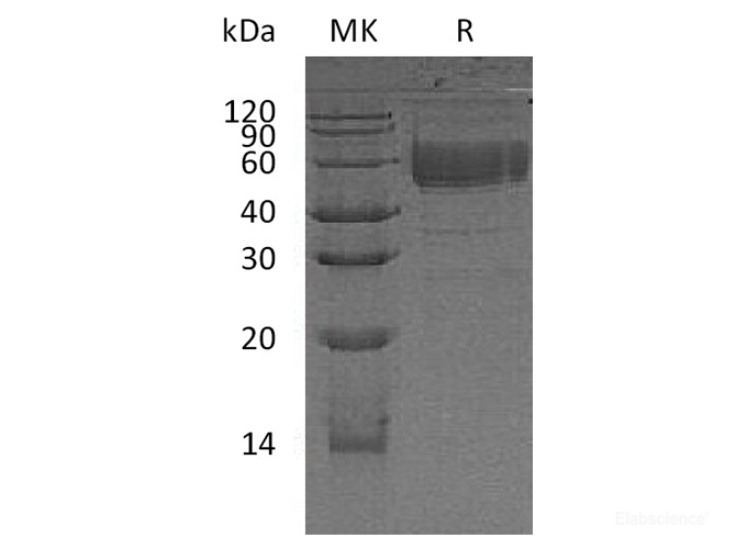 Recombinant Human CD83/HB15 Protein(C-Fc)-Elabscience