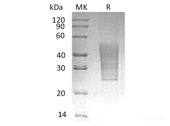 Recombinant Human CD99 Antigen-Like Protein 2/CD99L2 Protein(C-6His)-Elabscience