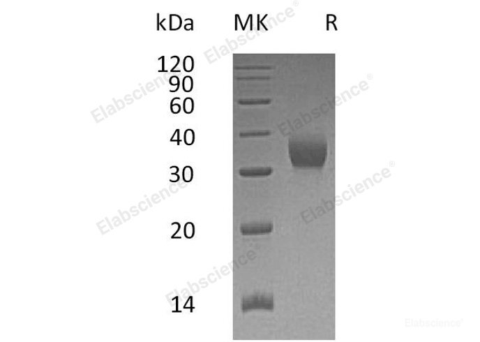 Recombinant Human CEACAM21 Protein(C-6His)-Elabscience