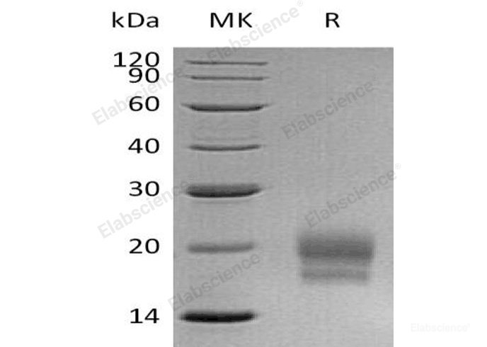 Recombinant Human CEACAM3/CD66d Protein(C-6His)-Elabscience
