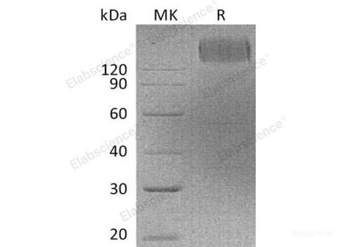 Recombinant Human CEACAM5/CD66e/CEA Protein(C-Fc)-Elabscience