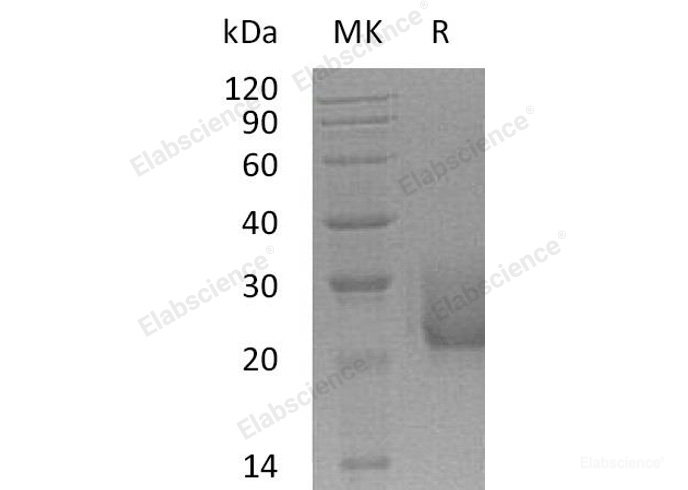 Recombinant Human CEACAM7/CGM2 Protein(C-6His)-Elabscience